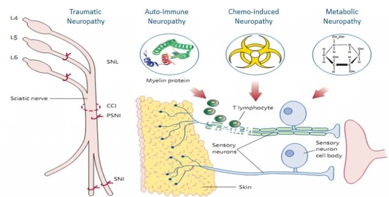 ANS Biotech: In vivo models and tests in neuropathic pain